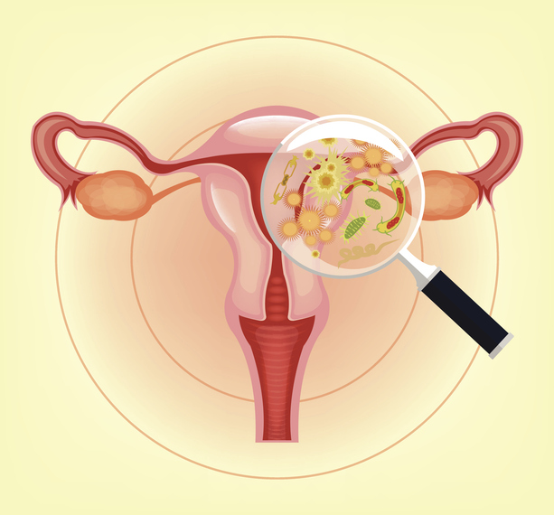 Ill female reproductive system with bacteria, germs and magnifier. Vector illustration