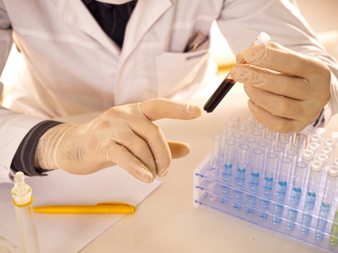 Researcher's hands close up. Doctor examines a test tube with a sample of contaminated blood