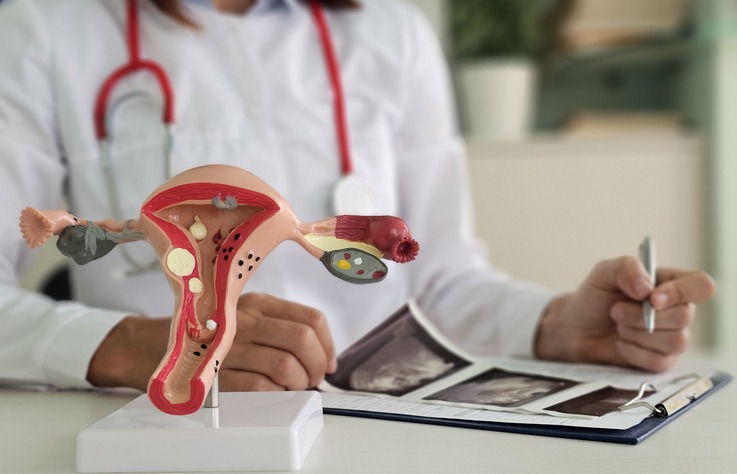 Doctor explaining changes in ovaries to patient on artificial model of uterus and showing ultrasound picture concept