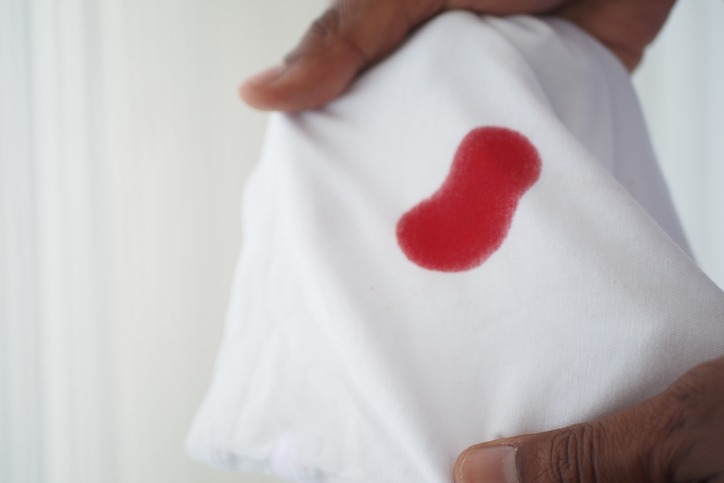 blood stains on a white shirt.