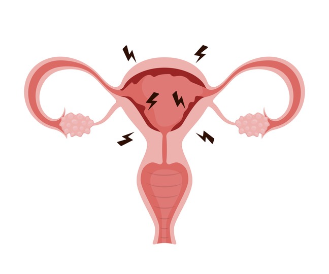 Female uterus with pain lightning bolts showing menstruation period
